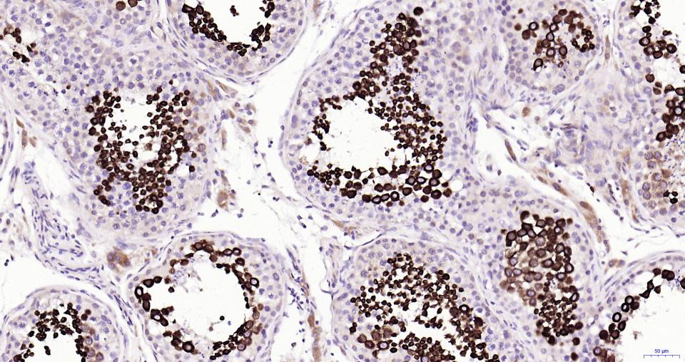 核因子2相关因子2重组兔单抗