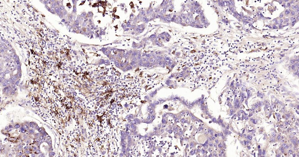 基质金属蛋白酶-9重组兔单抗