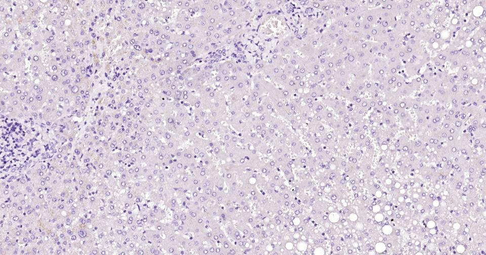 甲胎蛋白重组兔单克隆抗体