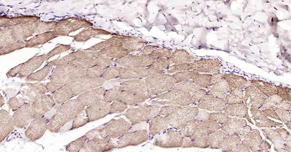 细胞色素C重组兔单抗