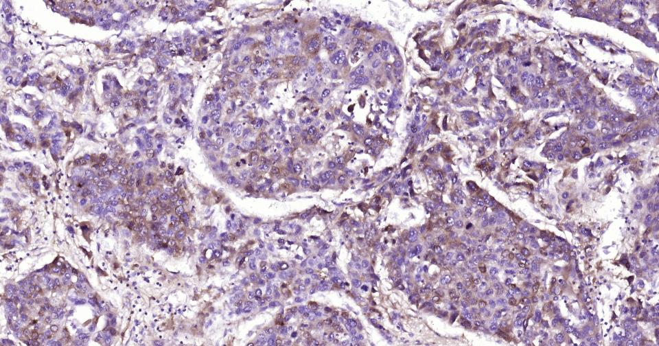 甲胎蛋白重组兔单克隆抗体