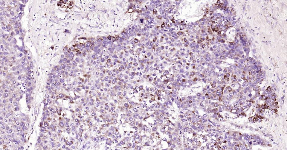 细胞色素C重组兔单抗
