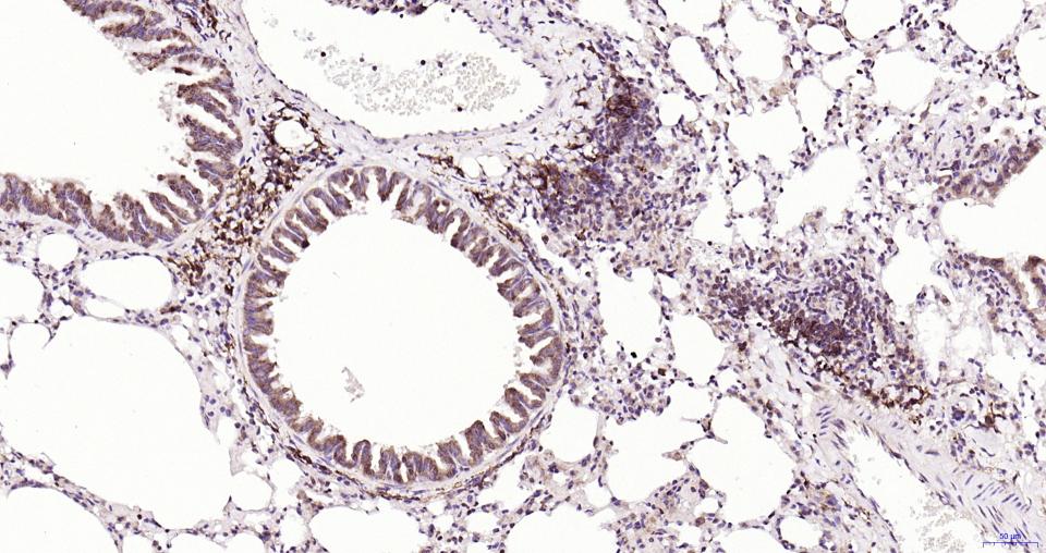 核因子2相关因子2重组兔单抗