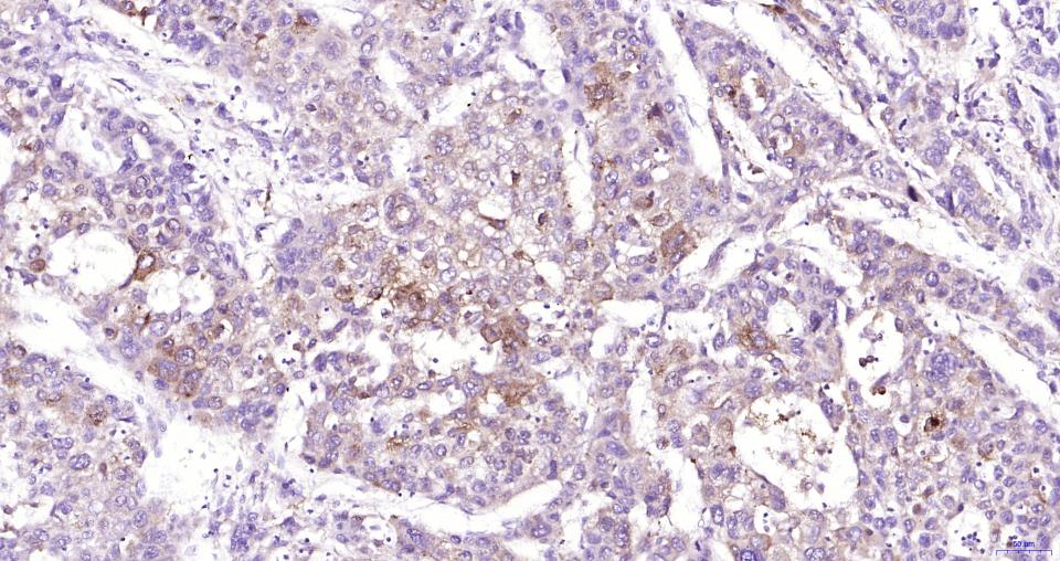 核因子2相关因子2重组兔单抗