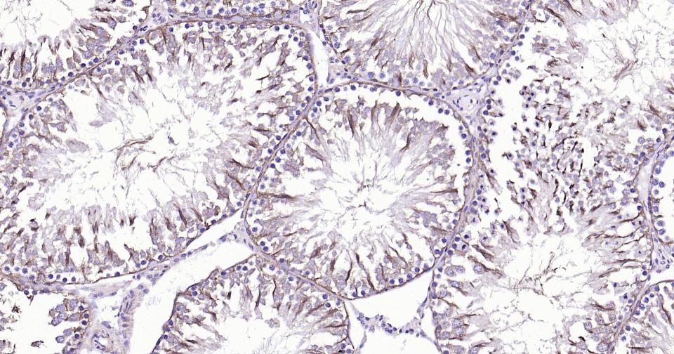 微管蛋白β tubulin/Tubulin β（内参）单克隆抗体-bsm-33034M