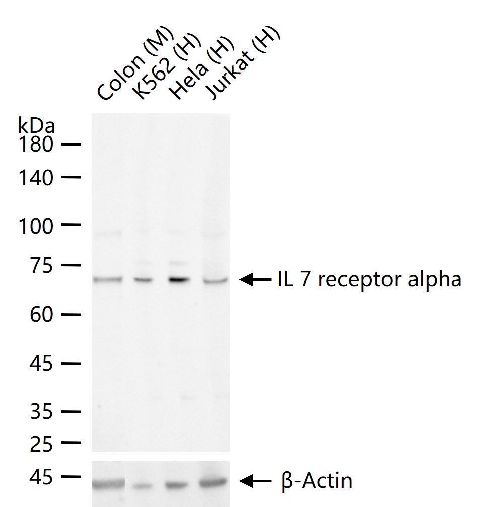 白细胞介素-7受体a（CD127）重组兔单抗