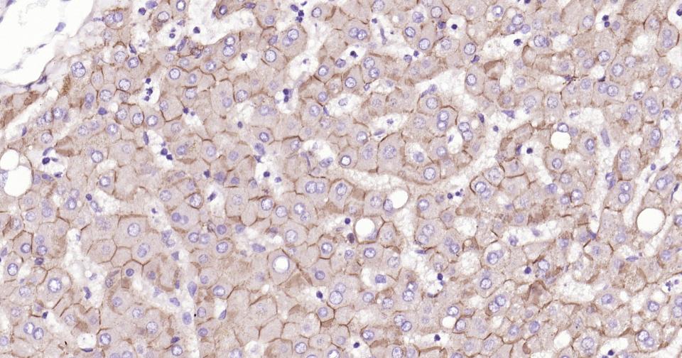 N-钙粘附分子重组兔单抗