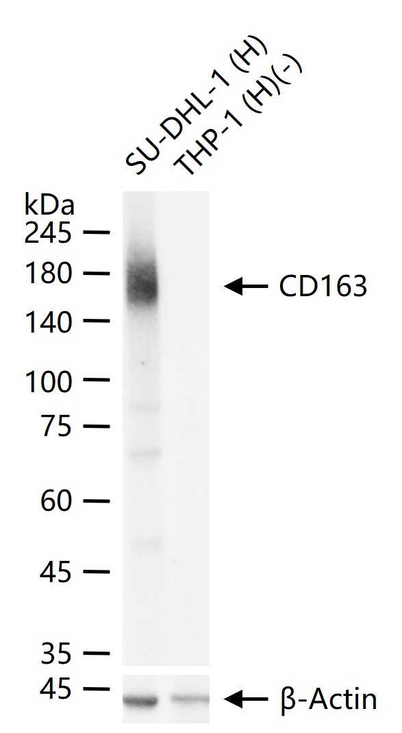 CD163重组兔单抗