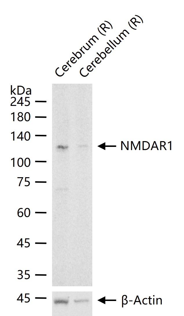 离子型谷氨酸受体1重组兔单抗