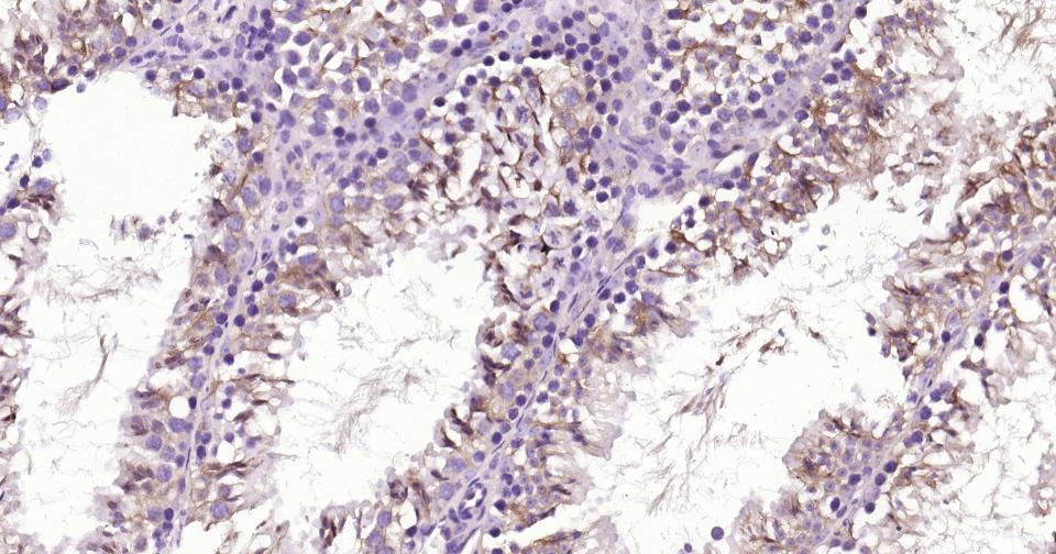 微管蛋白β tubulin/Tubulin β（内参）单克隆抗体-bsm-33034M