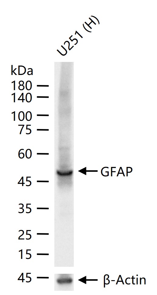 GFAP Mouse mAb (一抗) - WB,IHC-P,IHC-F,IF | Bioss