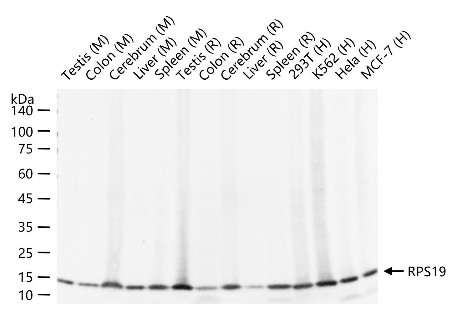 S19核糖体蛋白重组兔单抗
