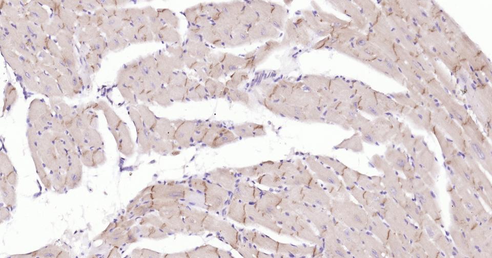 N-钙粘附分子重组兔单抗