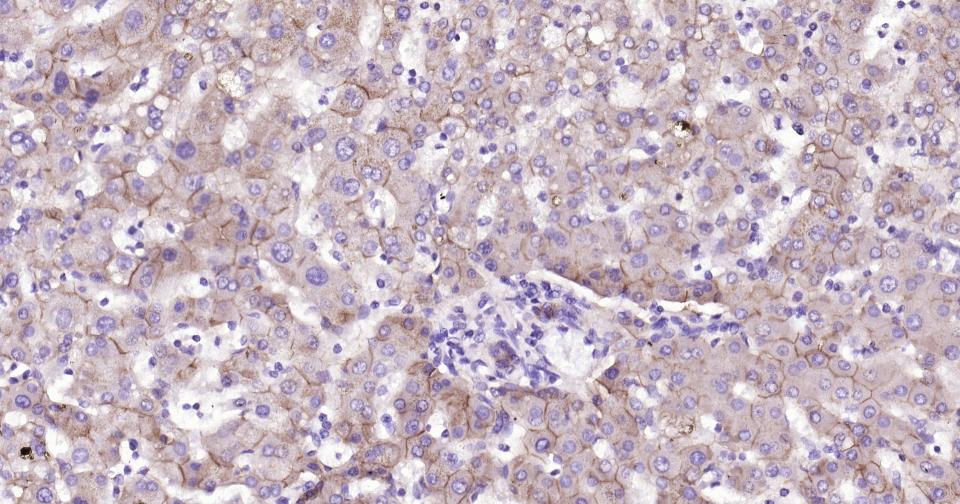 N-钙粘附分子重组兔单抗