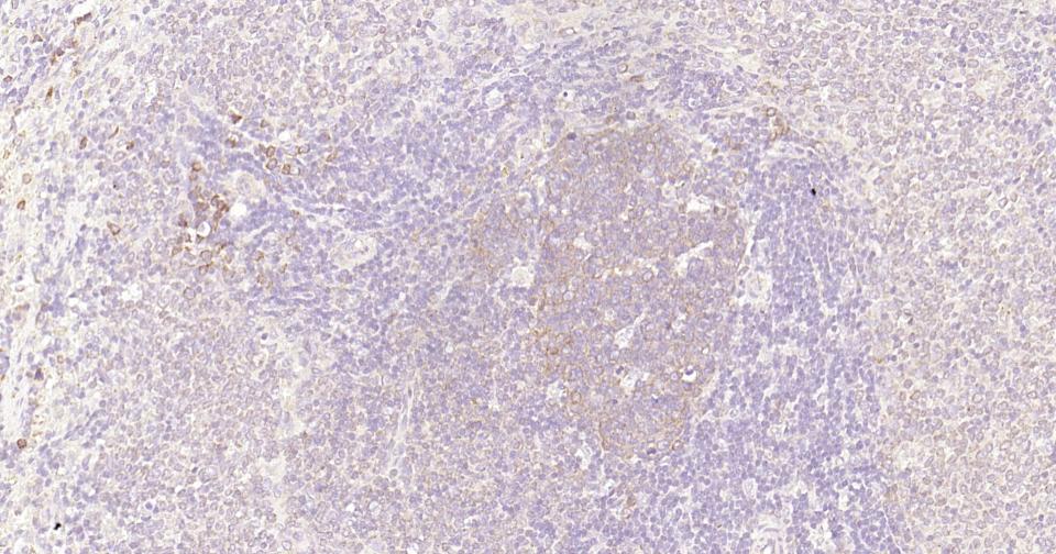 细胞核因子/k基因结合核因子重组兔单抗