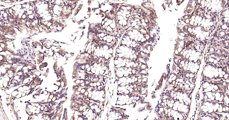 细胞核因子/k基因结合核因子重组兔单抗