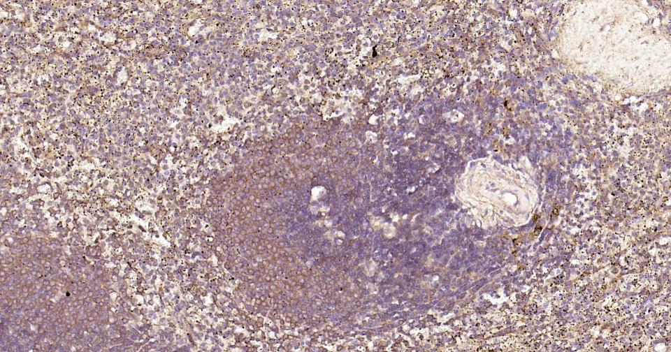 细胞核因子/k基因结合核因子重组兔单抗