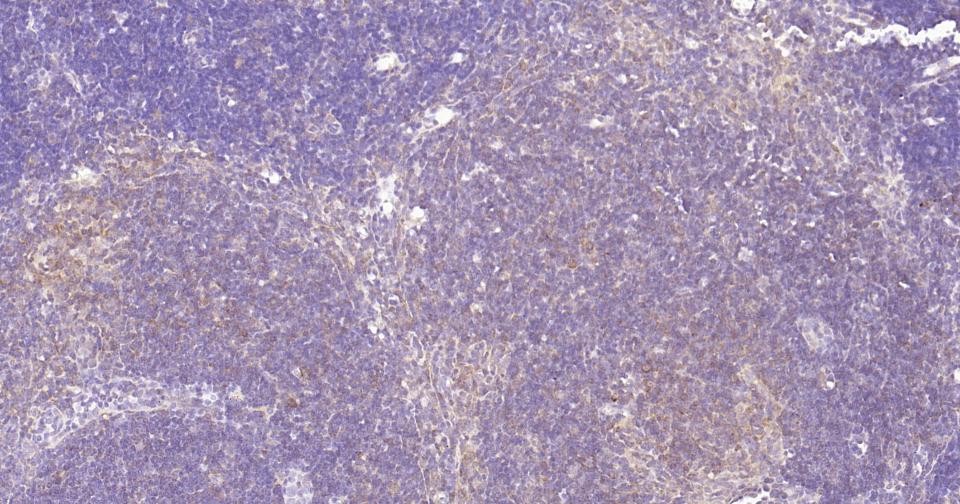 细胞核因子/k基因结合核因子重组兔单抗