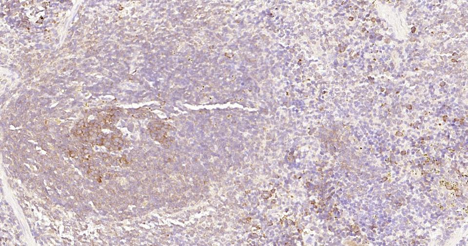 细胞核因子/k基因结合核因子重组兔单抗
