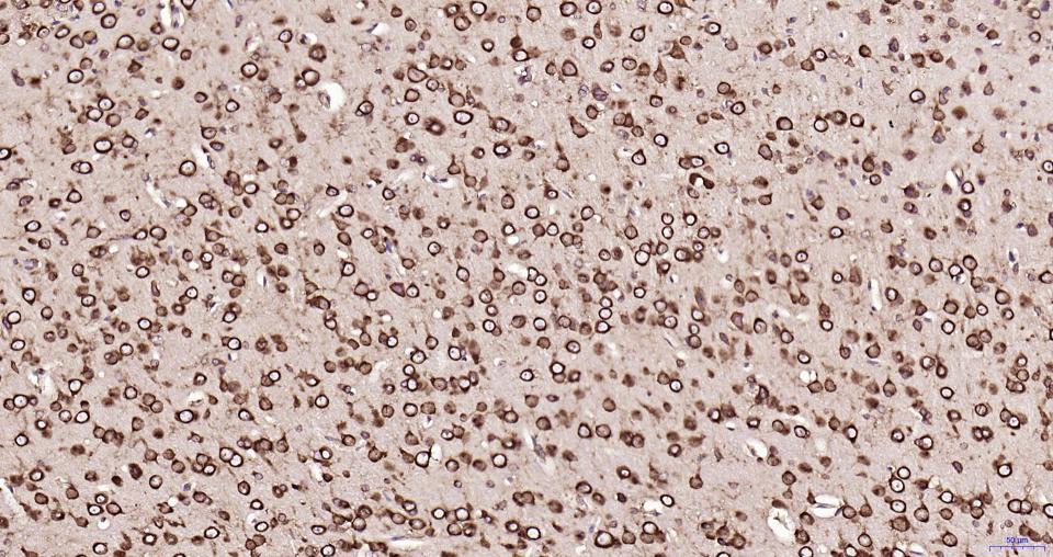 S19核糖体蛋白重组兔单抗