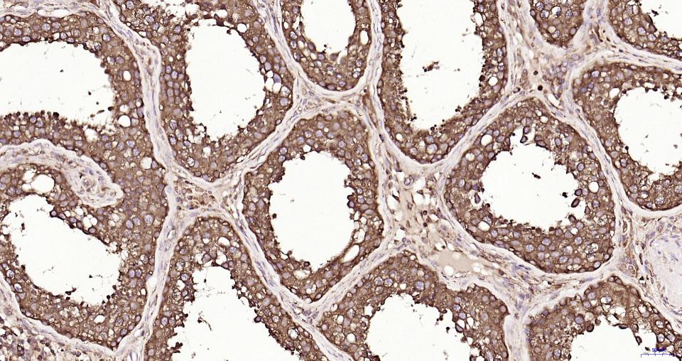 S19核糖体蛋白重组兔单抗