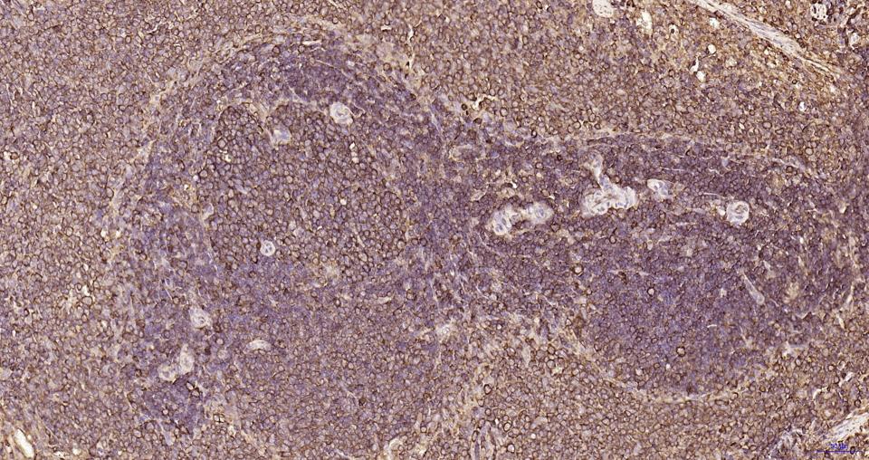 S19核糖体蛋白重组兔单抗