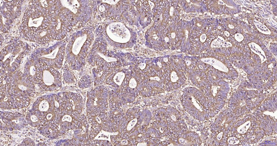 S19核糖体蛋白重组兔单抗