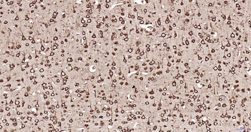 S19核糖体蛋白重组兔单抗