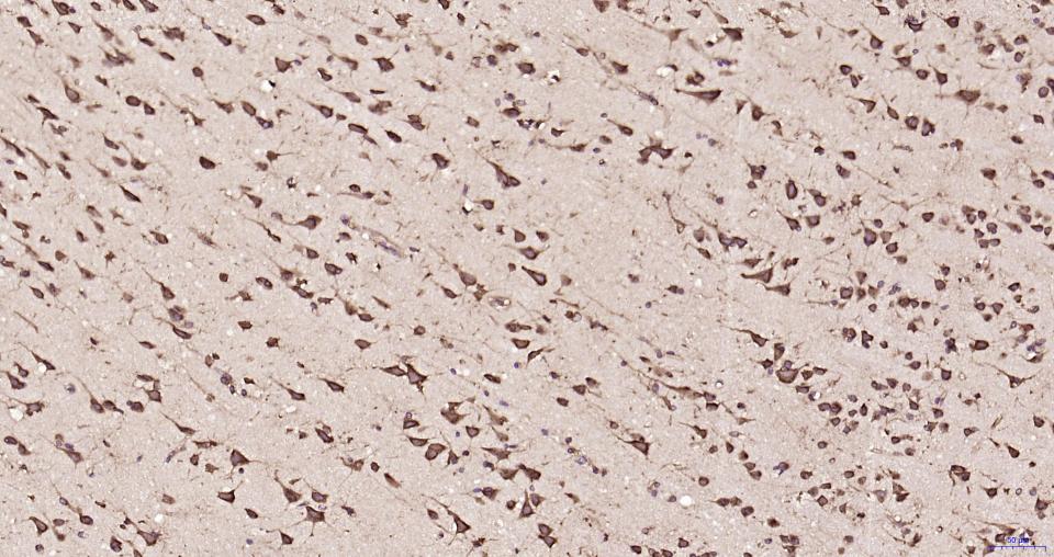 S19核糖体蛋白重组兔单抗