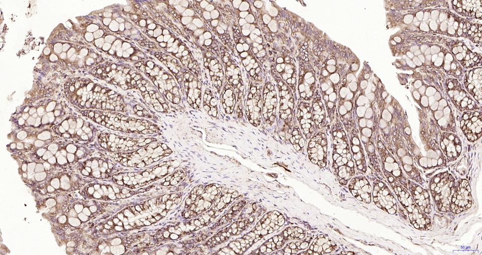 S19核糖体蛋白重组兔单抗