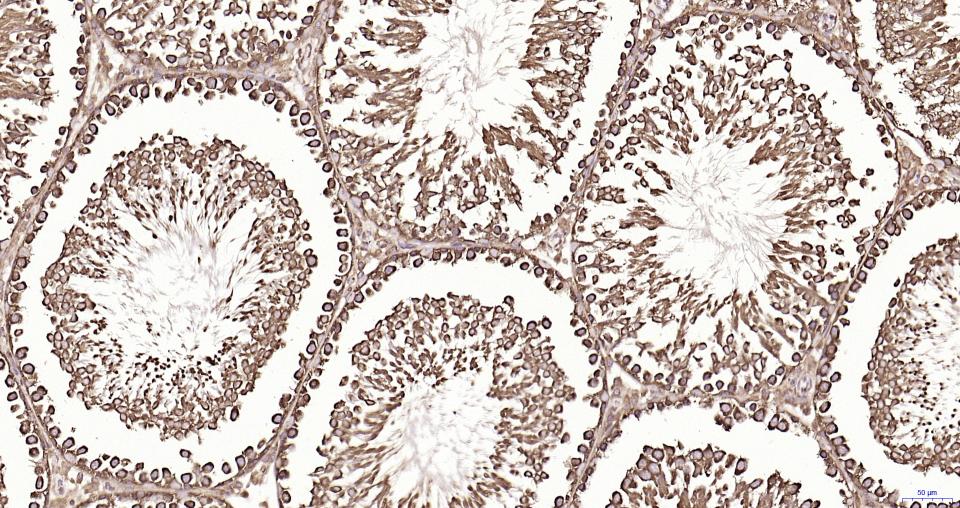 S19核糖体蛋白重组兔单抗