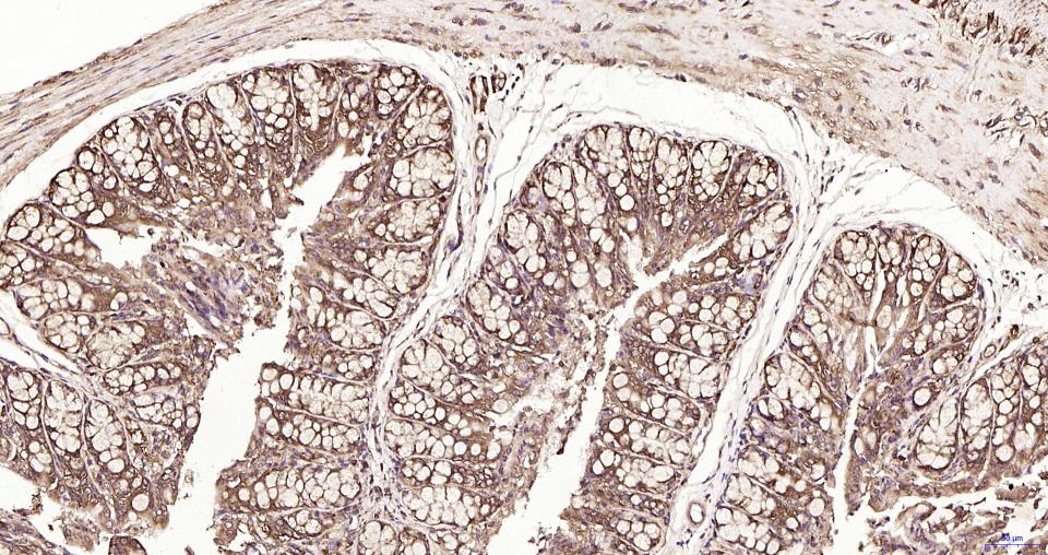 S19核糖体蛋白重组兔单抗