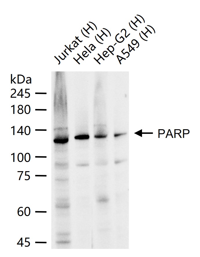 多腺苷二磷酸多聚酶重组兔单抗