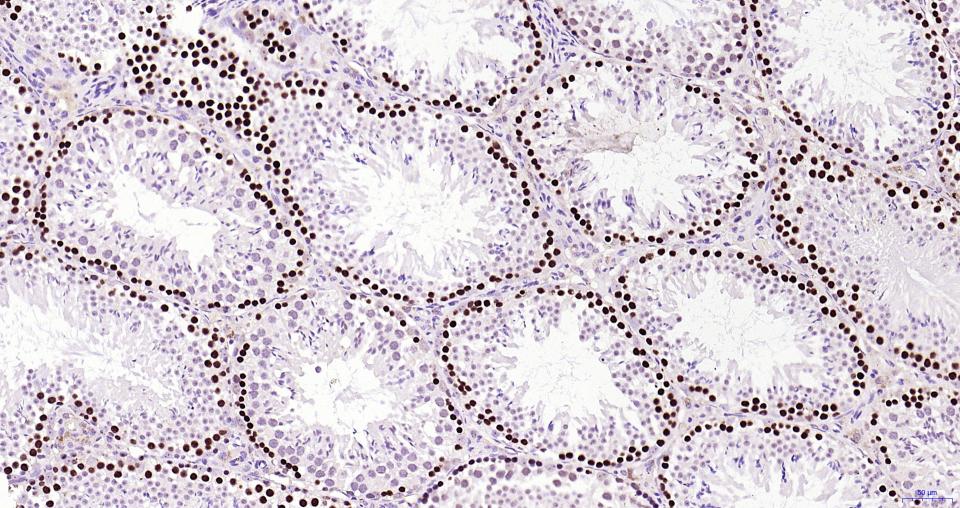 增殖细胞核抗原（核内参）重组兔单抗