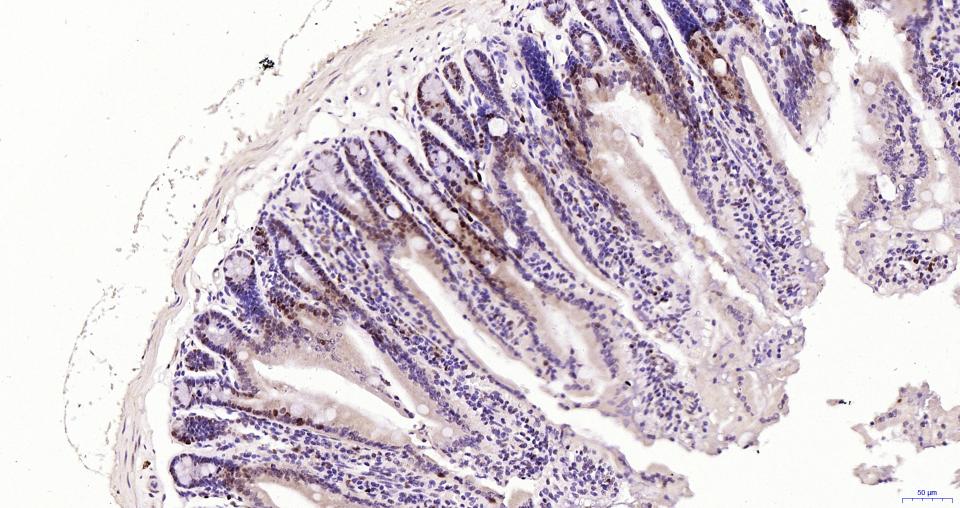 增殖细胞核抗原（核内参）重组兔单抗