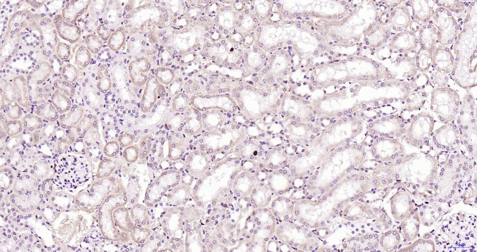 增殖细胞核抗原（核内参）重组兔单抗