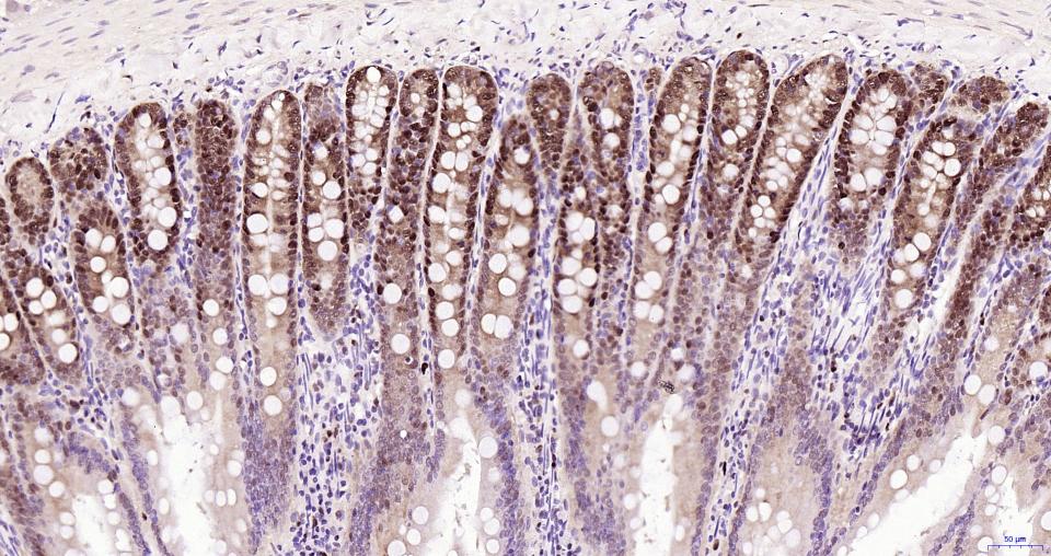 增殖细胞核抗原（核内参）重组兔单抗