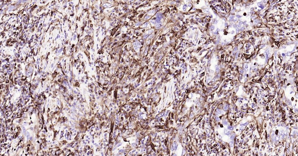 波形蛋白单克隆抗体-bsm-33170M