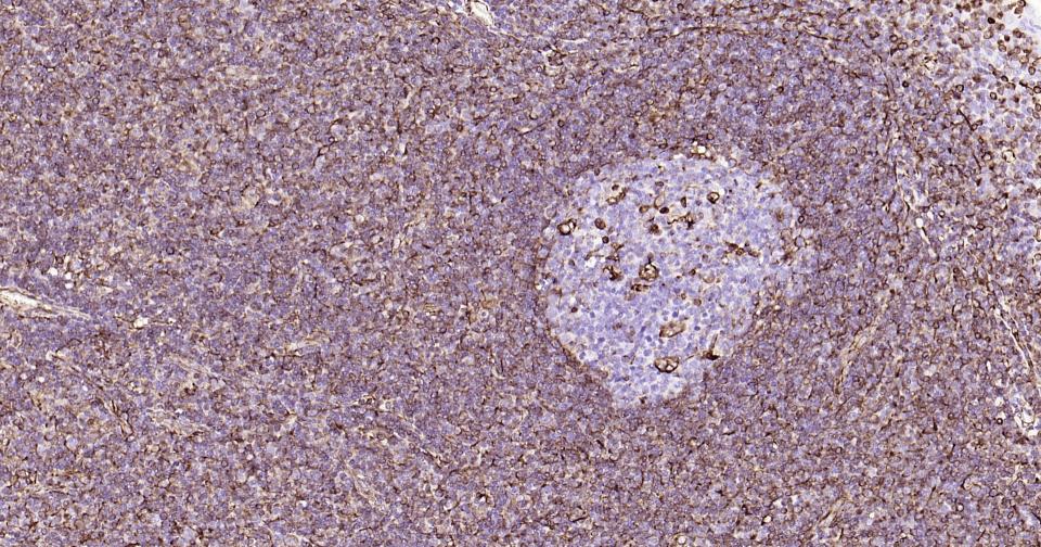 波形蛋白单克隆抗体-bsm-33170M