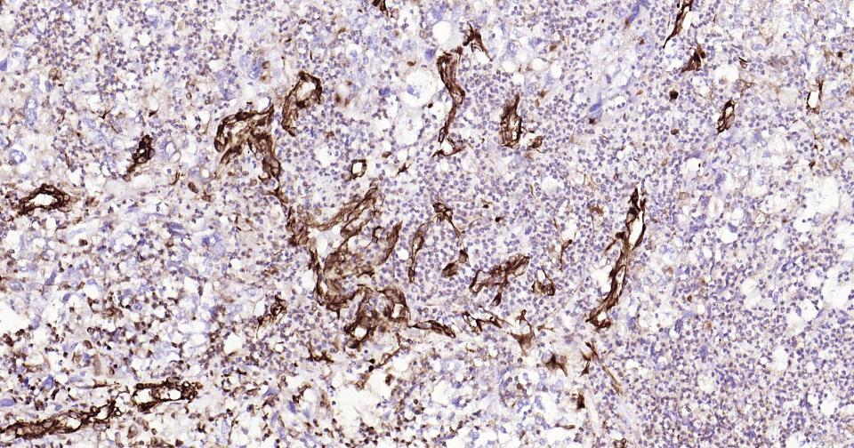 波形蛋白单克隆抗体-bsm-33170M