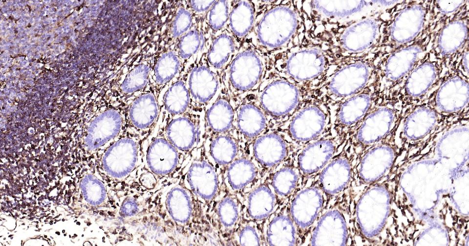 波形蛋白单克隆抗体-bsm-33170M