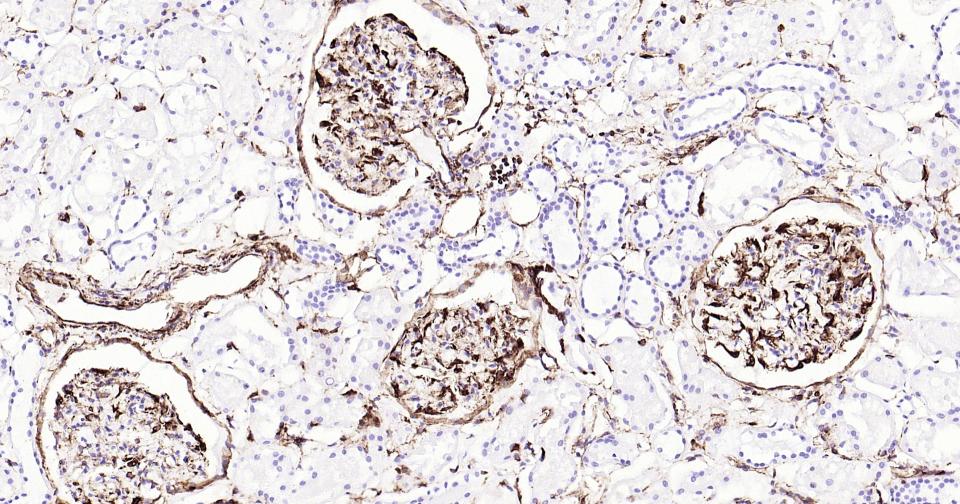 波形蛋白单克隆抗体-bsm-33170M
