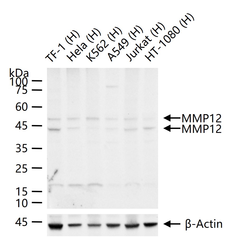 基质金属蛋白酶-12重组兔单抗