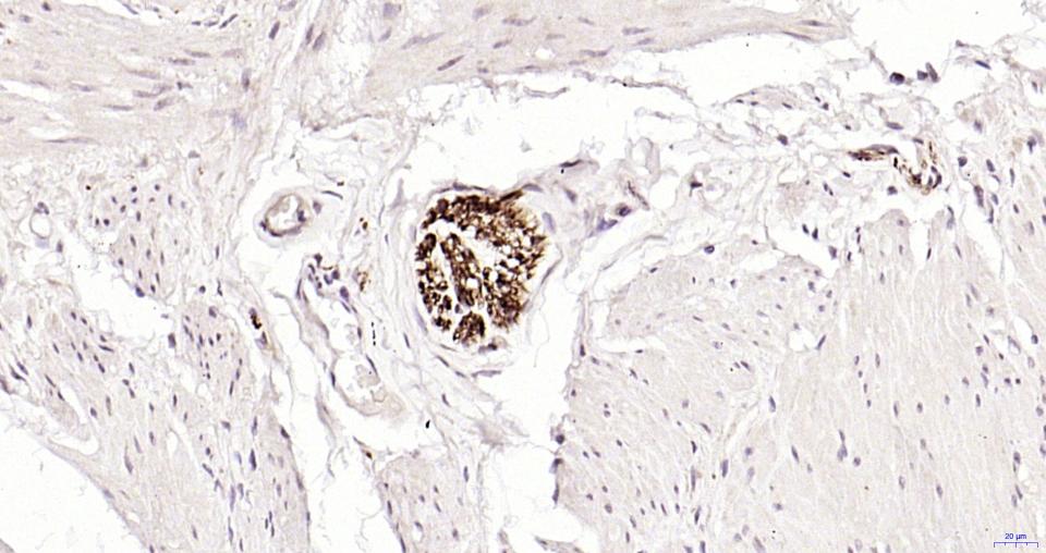 NEFM Recombinant Rabbit mAb (一抗) - WB,IHC-P,IHC-F,IF,ICC/IF | Bioss