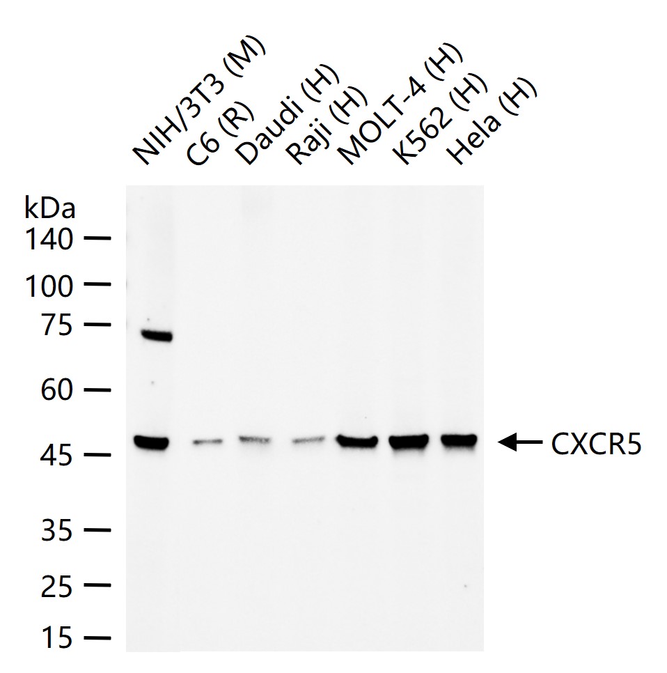 细胞表面趋化因子受体5（CD185）重组兔单抗