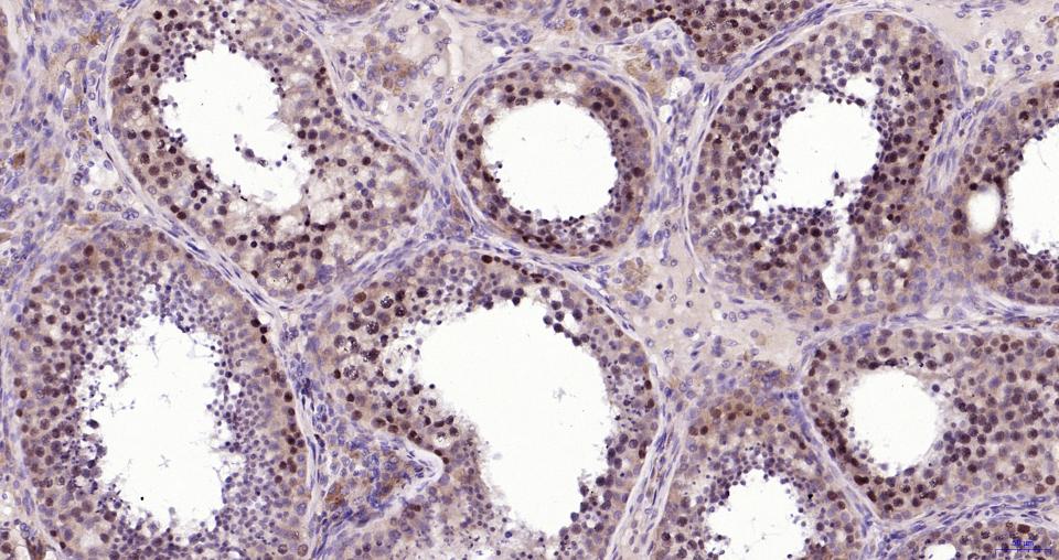 磷酸化核因子2相关因子2(Ser40)重组兔单抗