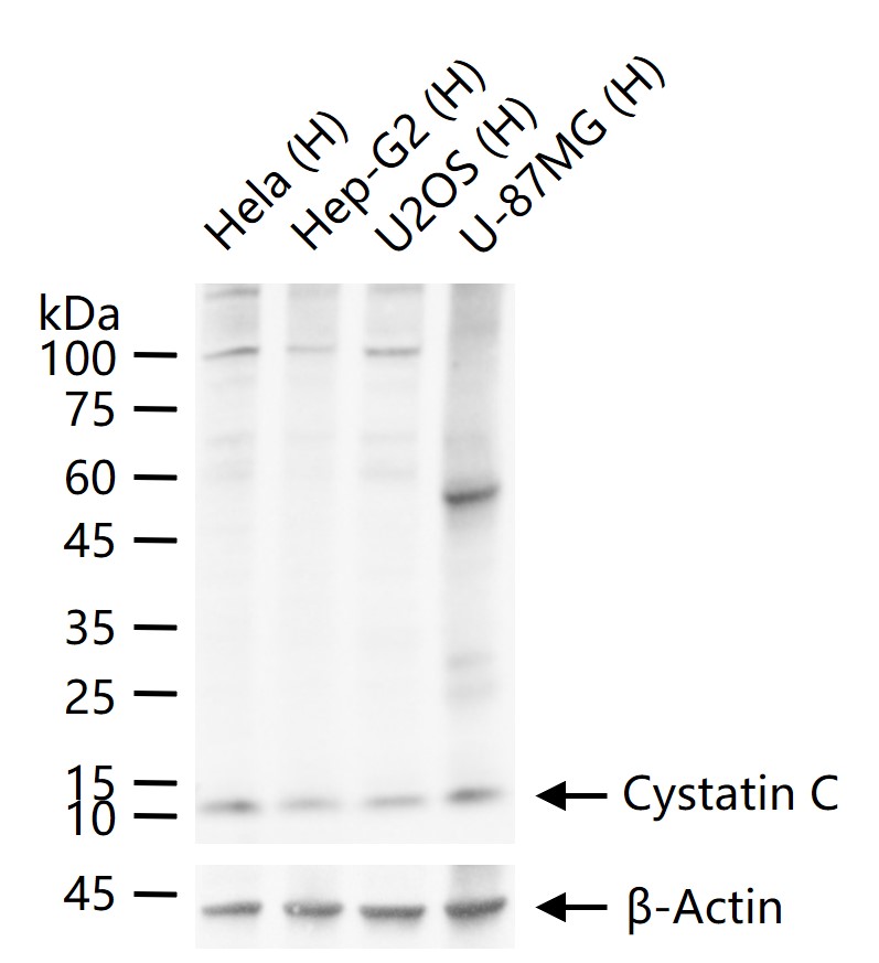 Cystatin C Mouse mAb (一抗) - WB,IHC-P,IHC-F,IF | Bioss