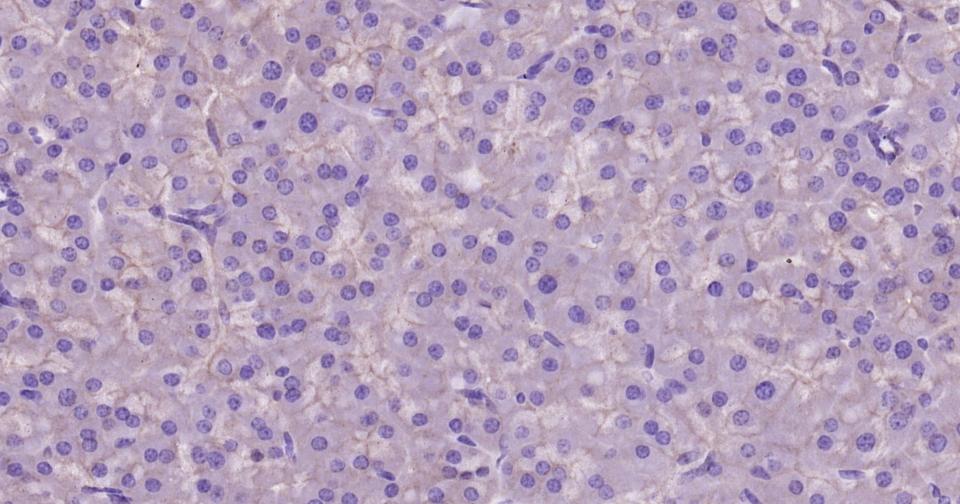 上皮钙粘附分子重组兔单抗