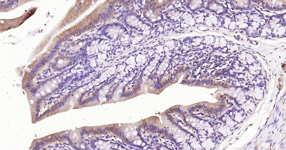 3-磷酸甘油醛脱氢酶(内参)抗体