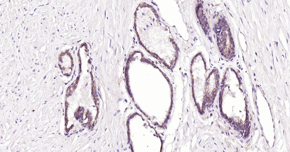 上皮钙粘附分子重组兔单抗